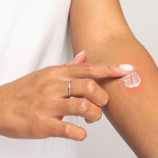 Woman applying moisturizer to her arm with skin irritated by keratosis pilaris